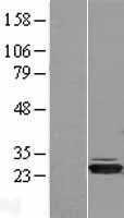 ls011112 hibadh human over expression lysates nm 152740 wb testing 1