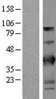 BTN3A2 Human Over-expression Lysates NM_007047