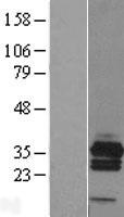 Calcipressin 3 (RCAN3) Human Over-expression Lysates NM_013441