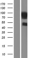 FAF1 Human Over-expression Lysates NM_007051