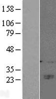 ls011126 cd160 human over expression lysates nm 007053 wb testing 1