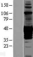 CDC42EP1 Human Over-expression Lysates NM_152243