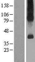 SLC7A9 Human Over-expression Lysates NM_014270