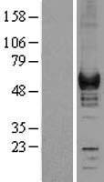 Coronin 1a (CORO1A) Human Over-expression Lysates NM_007074