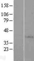 AP4S1 Human Over-expression Lysates NM_007077