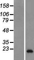 PTP4A3 Human Over-expression Lysates NM_032611