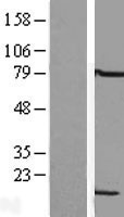 ls011157 lsm6 human over expression lysates nm 007080 wb testing 1