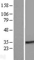 RABL2A Human Over-expression Lysates NM_013412