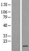 ERG28 (C14orf1) Human Over-expression Lysates NM_007176