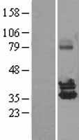 NUDT6 Human Over-expression Lysates NM_007083