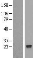 NUDT4 Human Over-expression Lysates NM_019094