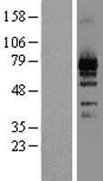 LZTS1 Human Over-expression Lysates NM_021020