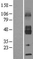 SLC2A6 Human Over-expression Lysates NM_017585