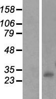INMT Human Over-expression Lysates NM_006774