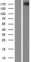 ls011188 nisch human over expression lysates nm 007184 wb testing 1