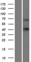 WW domain binding protein 4 (WBP4) Human Over-expression Lysates NM_007187