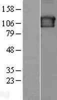 SEC23IP Human Over-expression Lysates NM_007190