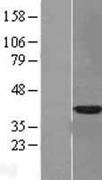 Annexin A10 (ANXA10) Human Over-expression Lysates NM_007193