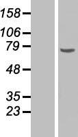 Chk2 (CHEK2) Human Over-expression Lysates NM_001005735