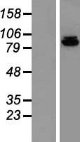 DNA Polymerase iota (POLI) Human Over-expression Lysates NM_007195