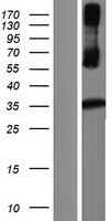 Kallikrein 8 (KLK8) Human Over-expression Lysates NM_144505