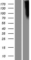 Frizzled 10 (FZD10) Human Over-expression Lysates NM_007197