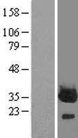 PLPBP Human Over-expression Lysates NM_007198