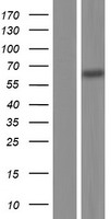 IRAKM (IRAK3) Human Over-expression Lysates NM_001142523