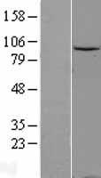 Gemin 3 (DDX20) Human Over-expression Lysates NM_007204
