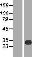 TREX2 Human Over-expression Lysates NM_080701
