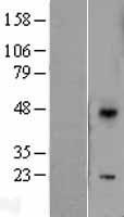 DUSP10 Human Over-expression Lysates NM_007207