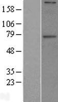 ls011226 galnt6 human over expression lysates nm 007210 wb testing 1