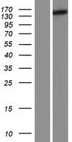 HPS5 Human Over-expression Lysates NM_181507