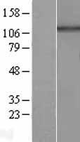 HPS5 Human Over-expression Lysates NM_181508