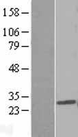 PDCD10 Human Over-expression Lysates NM_007217