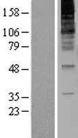 ls011236 rnf139 human over expression lysates nm 007218 wb testing 1