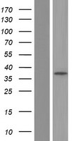 CA5B Human Over-expression Lysates NM_007220