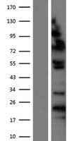 ls011244 zhx1 human over expression lysates nm 007222 wb testing 2