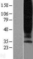 GPR45 Human Over-expression Lysates NM_007227