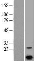 Calcium binding protein P22 (CHP1) Human Over-expression Lysates NM_007236
