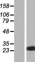 PXMP4 Human Over-expression Lysates NM_007238