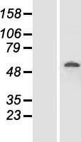 DDX19B Human Over-expression Lysates NM_001014449