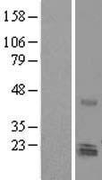 Nurim (NRM) Human Over-expression Lysates NM_007243