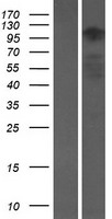 Ataxin 2 like (ATXN2L) Human Over-expression Lysates NM_148414