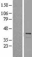 TREX1 Human Over-expression Lysates NM_016381