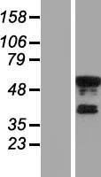 KLF8 Human Over-expression Lysates NM_007250