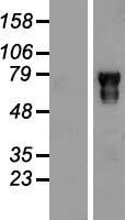 POU6F2 Human Over-expression Lysates NM_007252