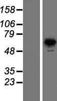 PNK (PNKP) Human Over-expression Lysates NM_007254