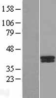 B4GALT7 Human Over-expression Lysates NM_007255