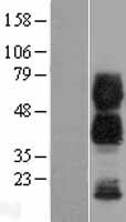 CD300 antigen (CD300A) Human Over-expression Lysates NM_007261